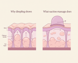 Beauty Cellulite Pro 8